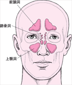 副鼻腔炎図1